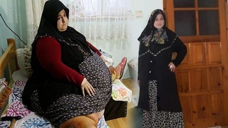 155 kilo veren Sevim Bal koronaya yenik düştü