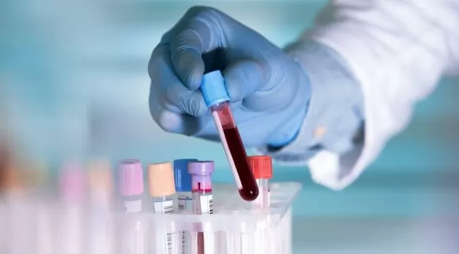 50 kanser türünü teşhis edebilen kan testi geliştirdiler
