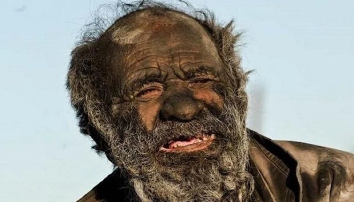 50 yıldır banyo yapmayan adam hayatını kaybetti