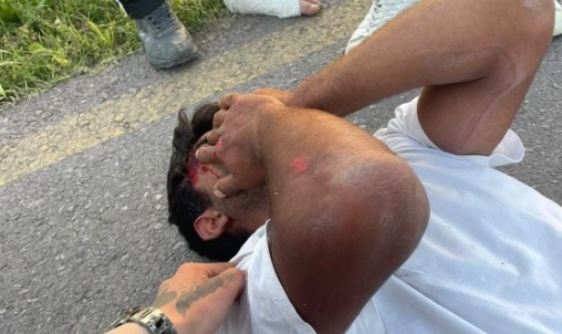 Acı içinde ambulans bekledi