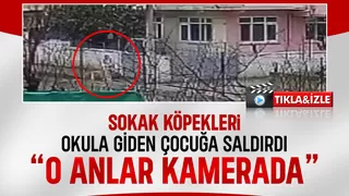 Akyazı'da belediye sessiz Köpekler bir çocuğa daha saldırdı