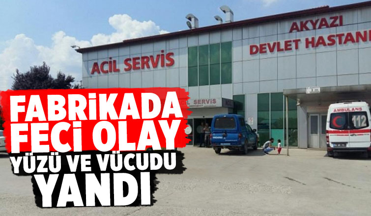 Akyazı'da iş kazası yüzü ve vücudu yandı