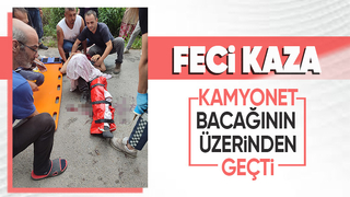 Akyazıdaki kazada 14 yaşındaki çocuk yaralandı
