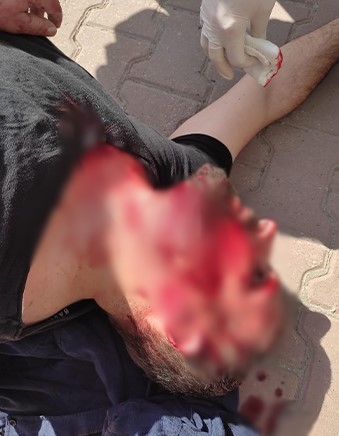 Alacağı için öldüresiye dövülen müzisyen o anları anlattı