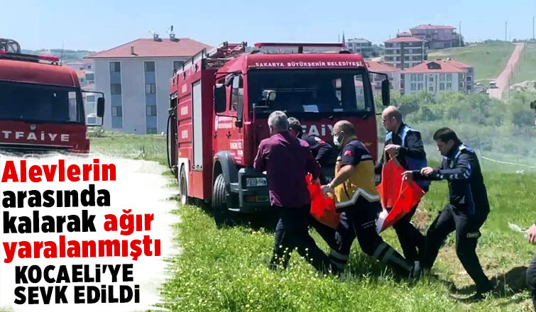 Alevlerin arasında kalmıştı  yanık merkezine sevk edild