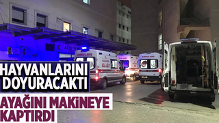 Ayağını makineye kaptırdı