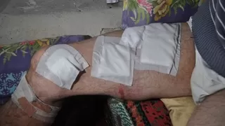 Ayı saldırısından şans eseri kurtuldu