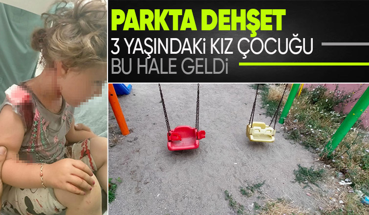 Bakımsız parkta salıncaktan düşen çocuk ölümden döndü