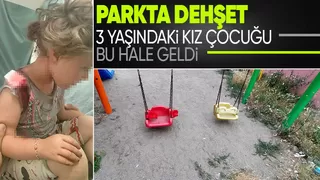 Bakımsız parkta salıncaktan düşen çocuk ölümden döndü