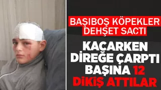 Başıboş köpekler çocuğu bu hale getirdi