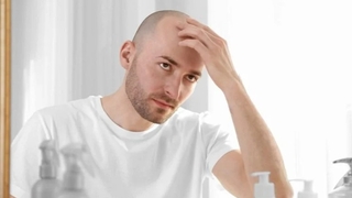 Bilim insanları uyardı: Kellik riskini artırıyor