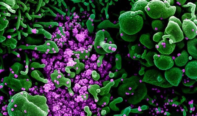 Bilim insanlarından antikor çalışması: Hayat boyu sürebilir