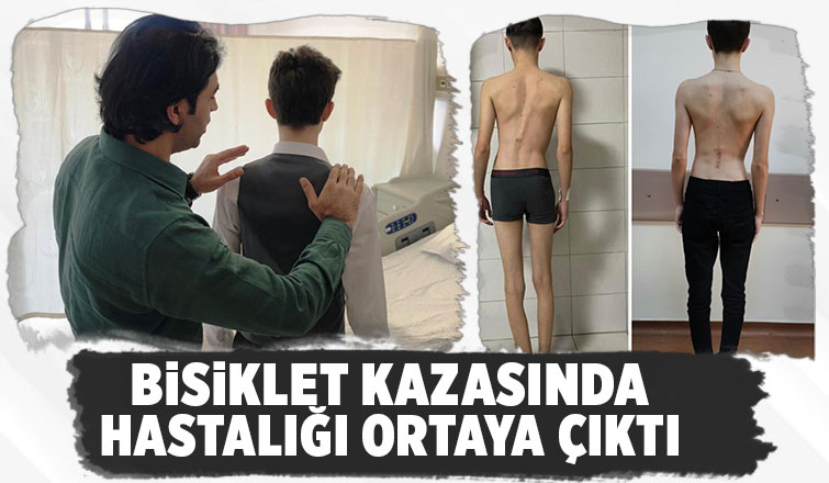 Bisiklet kazasıyla hastalığı fark edildi