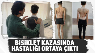 Bisiklet kazasıyla hastalığı fark edildi