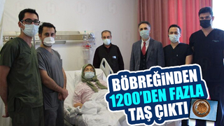 Böbreğinden 1200'den fazla taş çıktı