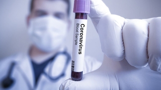 Can kaybı düne göre arttı