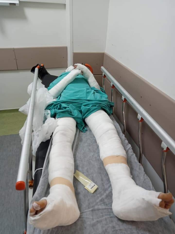 Çapa motoru dehşeti; Bu hale geldi