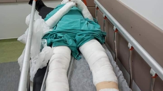 Çapa motoru dehşeti; Bu hale geldi