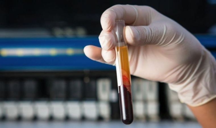 Çarpıcı araştırma: 50'den fazla kanser türünü tespit edebilir