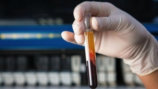 Çarpıcı araştırma: 50'den fazla kanser türünü tespit edebilir