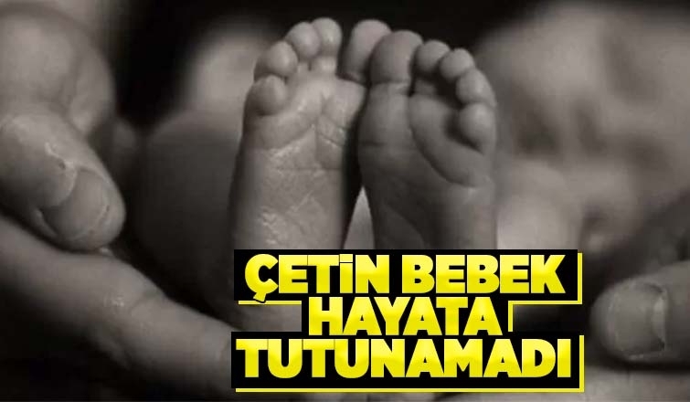 Çetin bebekten acı haber