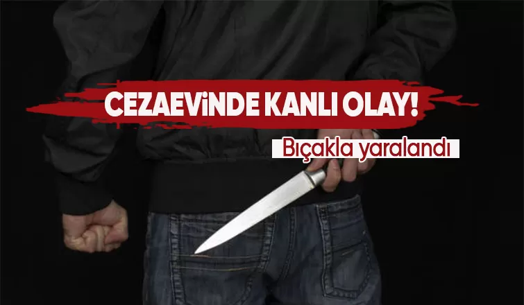 Cezaevinde kanlı olay! Bıçakla yaralandı