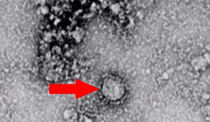 Çin’den bir virüs daha çıktı! 7 kişi hayatını kaybetti