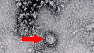 Çin’den bir virüs daha çıktı! 7 kişi hayatını kaybetti