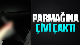 Çiviyi yanlışlıkla parmağına çaktı