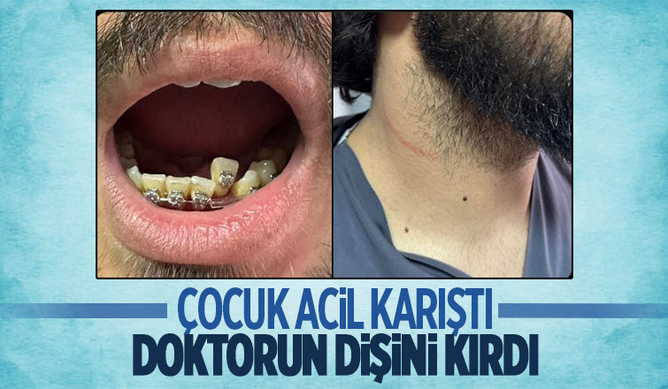 Çocuk acilde doktora saldırdı: Dişi kırıldı