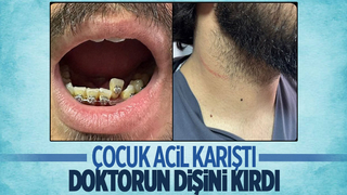 Çocuk acilde doktora saldırdı: Dişi kırıldı