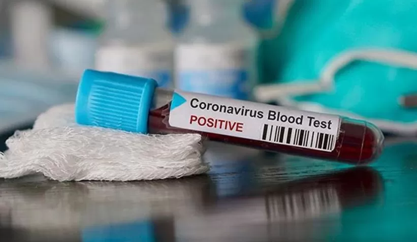 Covid-19 araştırması: Yedi farklı semptom grubu var