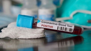 Covid-19 araştırması: Yedi farklı semptom grubu var