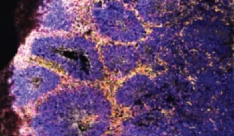 Covid-19 beyin hücrelerini öldürüyor