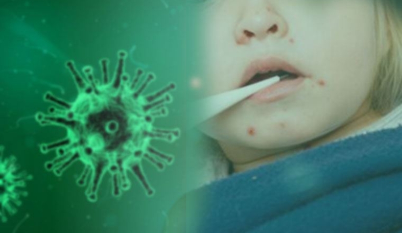 Covid-19 kısıtlamaları “kızamık” vakalarını arttırdı