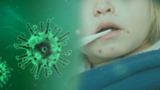 Covid-19 kısıtlamaları “kızamık” vakalarını arttırdı