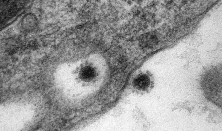 Delta Plus mutasyonu görüntülendi