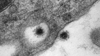 Delta Plus mutasyonu görüntülendi