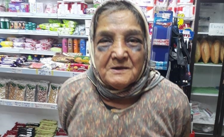 Demir çubukla dövdüğü eşini, bu hale soktu