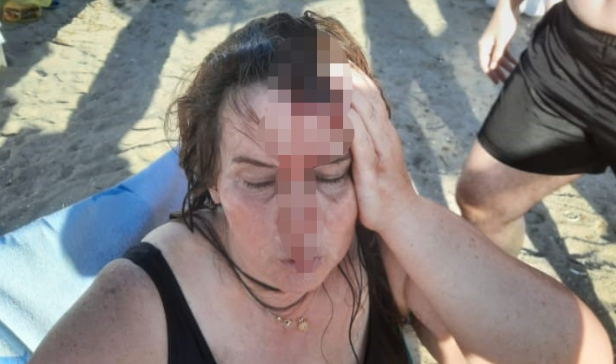  Denizde yüzerken jet ski çarptı, ölümden döndü