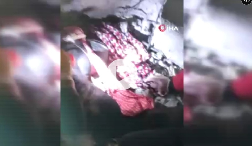 Depremde kahreden detay! Enkazdan ayağı kesilerek kurtarıldı