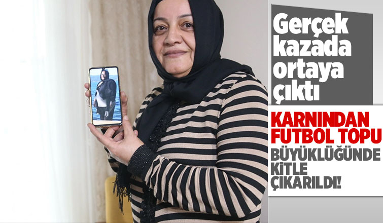 Doktorlar şokta: Tam 9 kilo