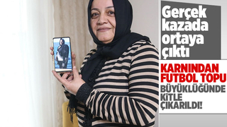 Doktorlar şokta: Tam 9 kilo