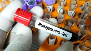 DSÖ, maymun çiçeği varyantlarına yeni isim verdi