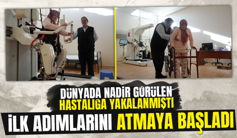 Dünyada nadir görülen hastalığa yakalandı