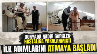 Dünyada nadir görülen hastalığa yakalandı