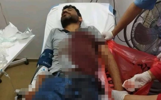 Elektrik sayacı okurken köpek parçaladı!