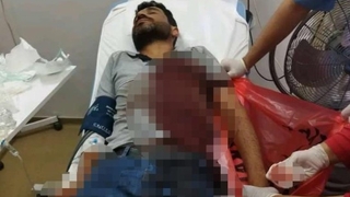 Elektrik sayacı okurken köpek parçaladı!