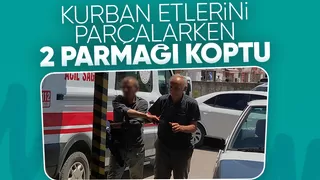 Elini şerit makinesine kaptırdı, iki parmağı koptu