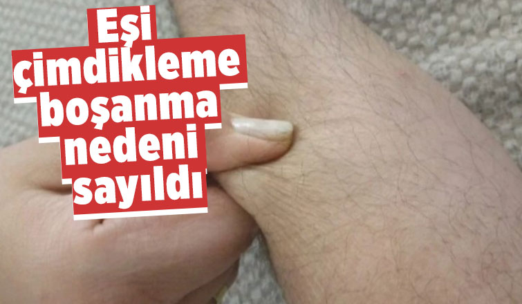 Eşi çimdikleme boşanma nedeni sayıldı